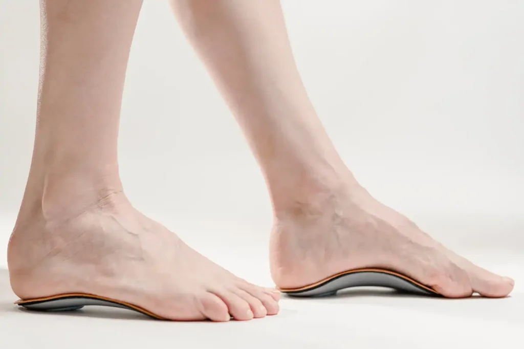 Orthopedic Insoles for Flat Feet
