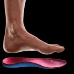 orthopedic insoles for plantar fasciitis